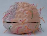 Diffuse Axonal Injury